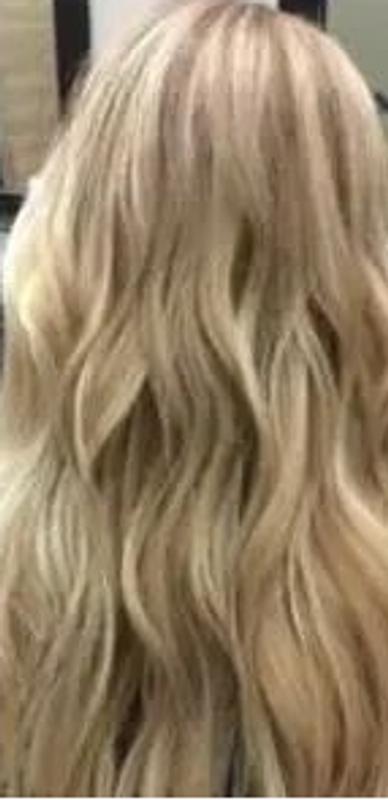 After toning the third bleaching session. Significant.