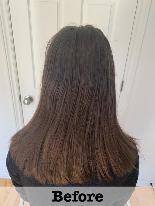 Before Treatment: teen 2