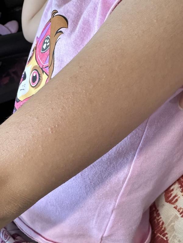 During application and After application