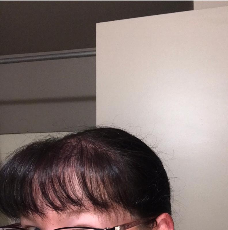 After....plus I washed it to try to get rid of the black