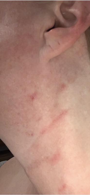 Reactions to products that say, they are gentle and are not
