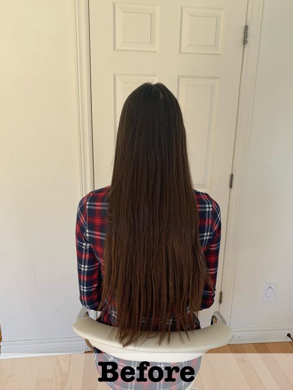 Before treatment, teen 1