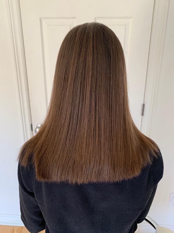 After treatment, teen 2