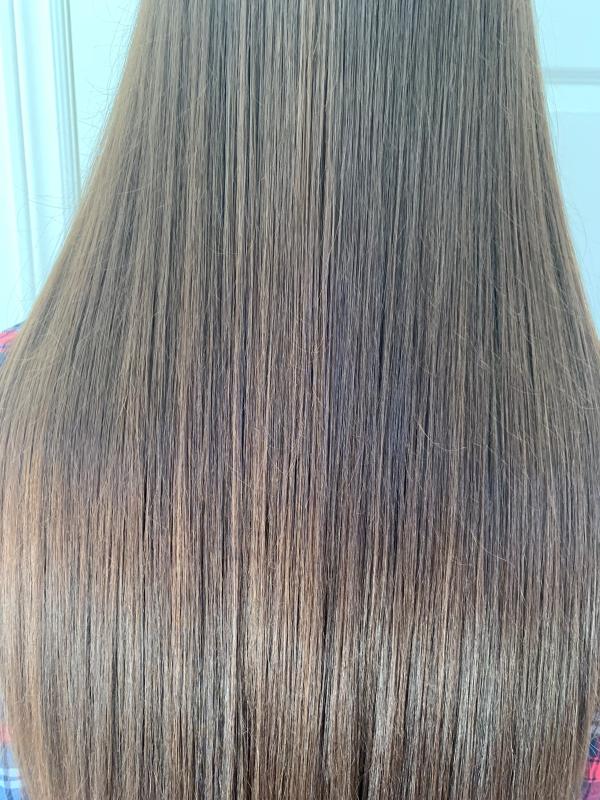 After treatment, teen 1, closeup