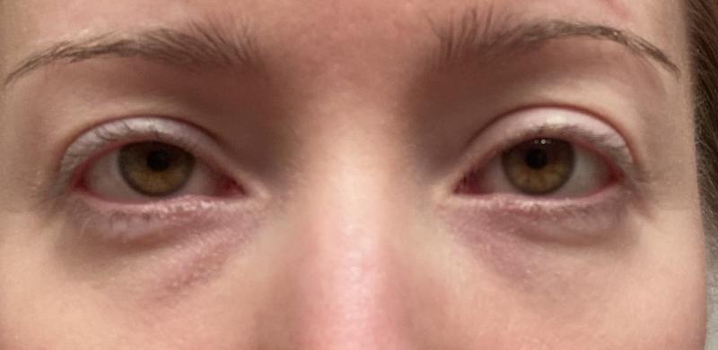 My before and after photos