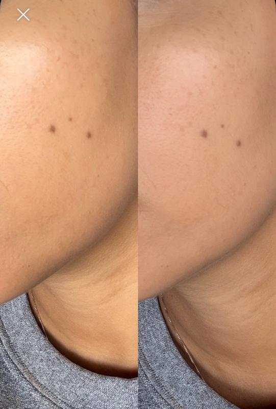 Review Thumbnail Image 0 383167133