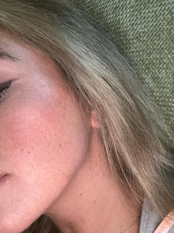 Review Thumbnail Image 0 382809297