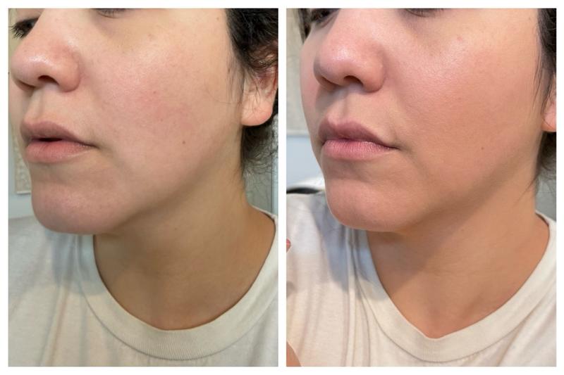 Review Thumbnail Image 0 384383118