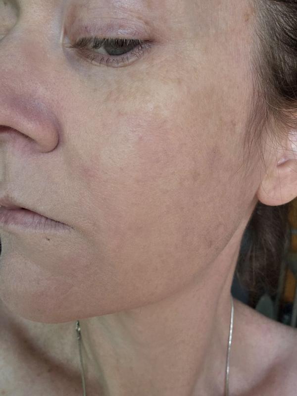 Review Thumbnail Image 3 381360404