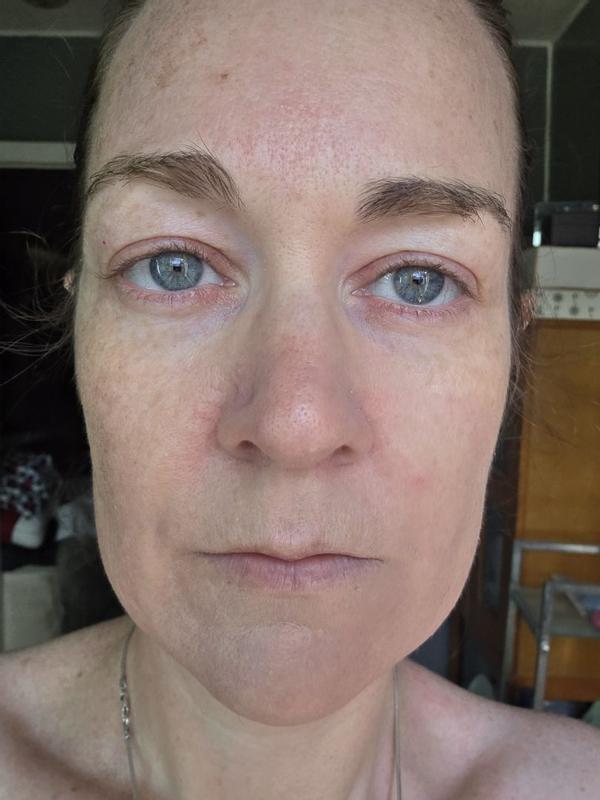 Review Thumbnail Image 1 381360404