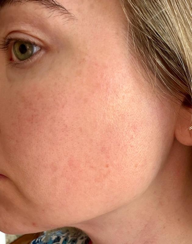 Customer carousel item 11.