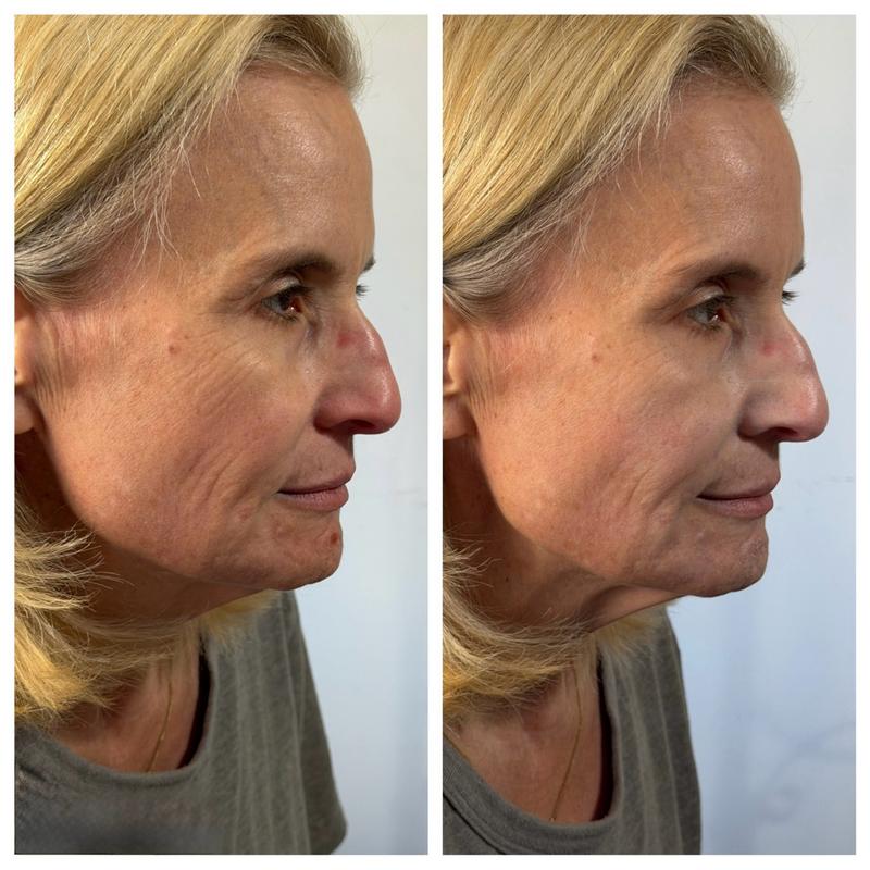 Customer carousel item 12.