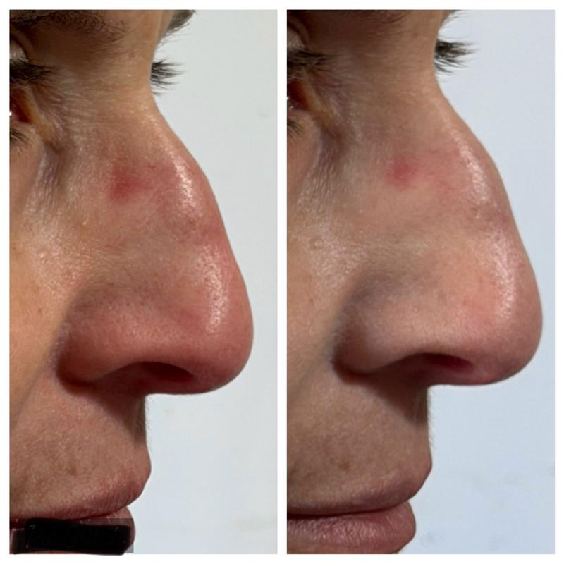 Customer carousel item 13.