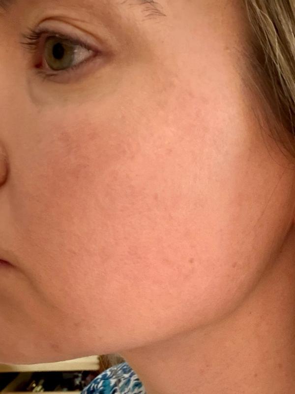 Customer carousel item 10.