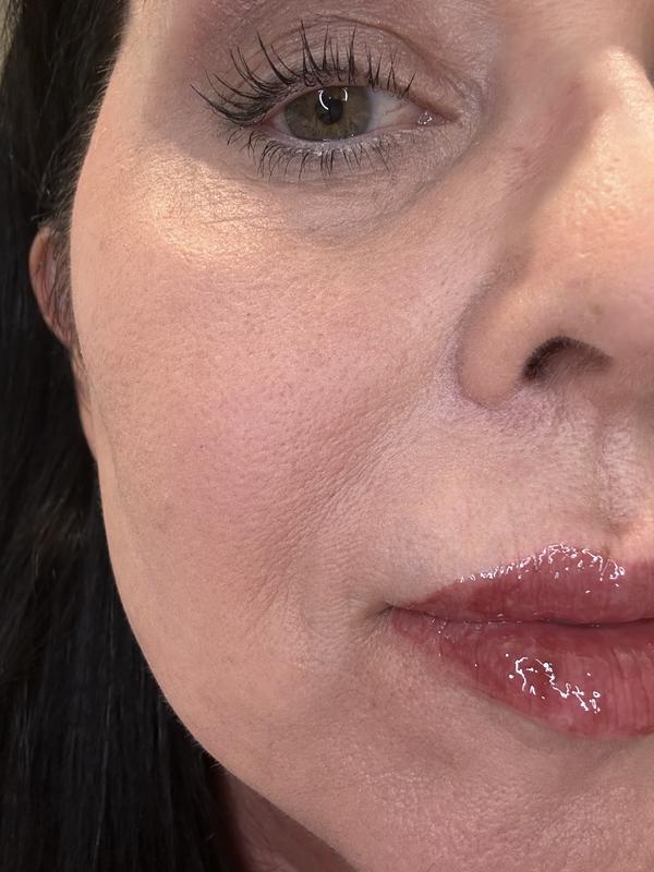 Vertigo Lift R eye