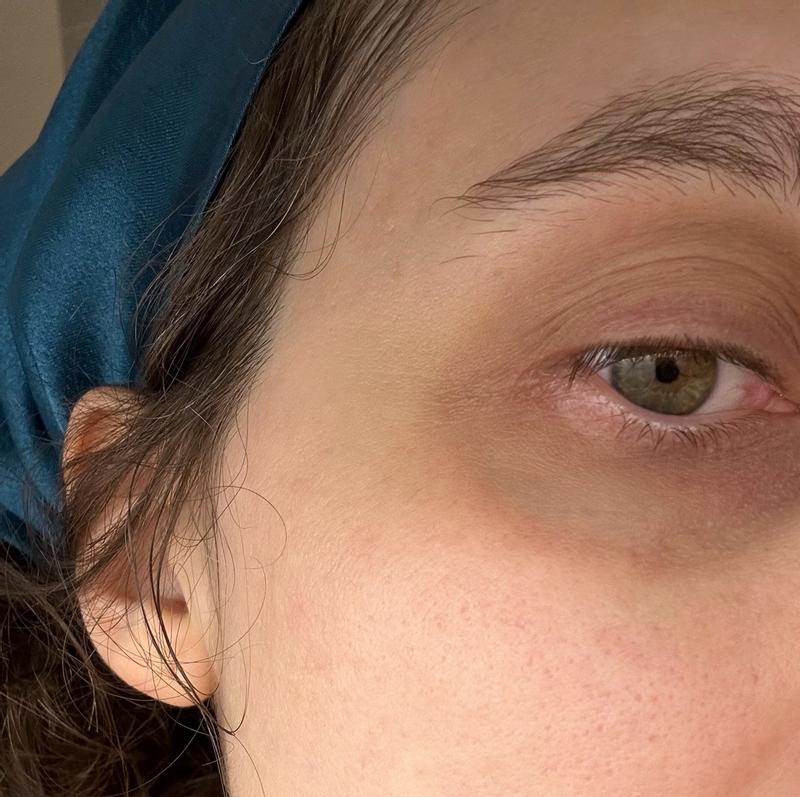 Customer photo for "Good pick me up for your skin after long days"