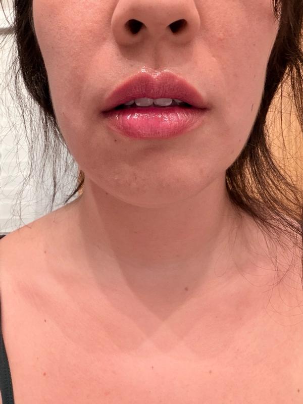 Review Thumbnail Image 1 384101001