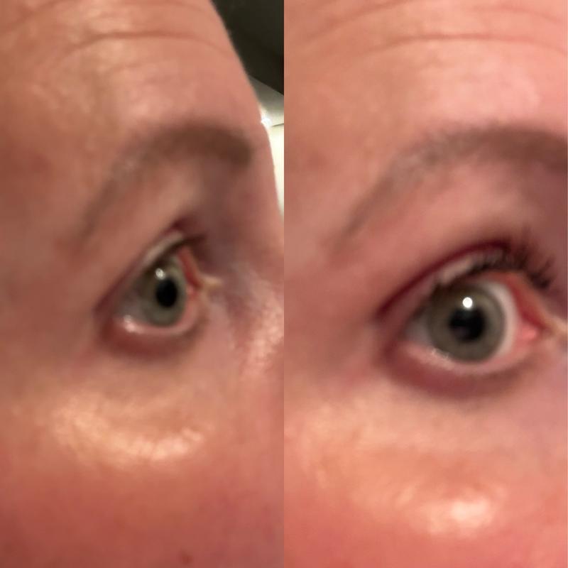 Review Thumbnail Image 0 385229643