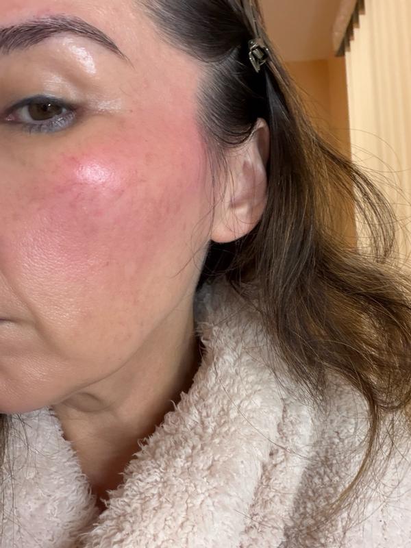 Review Thumbnail Image 4 385169775