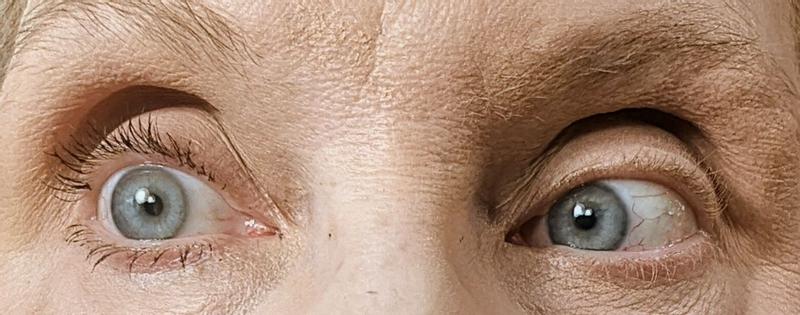 Review Thumbnail Image 0 383536408