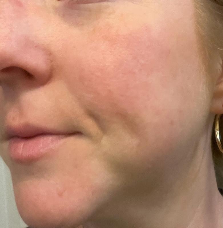 Review Thumbnail Image 1 384989090