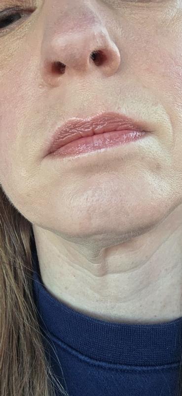 Review Thumbnail Image 1 385138698