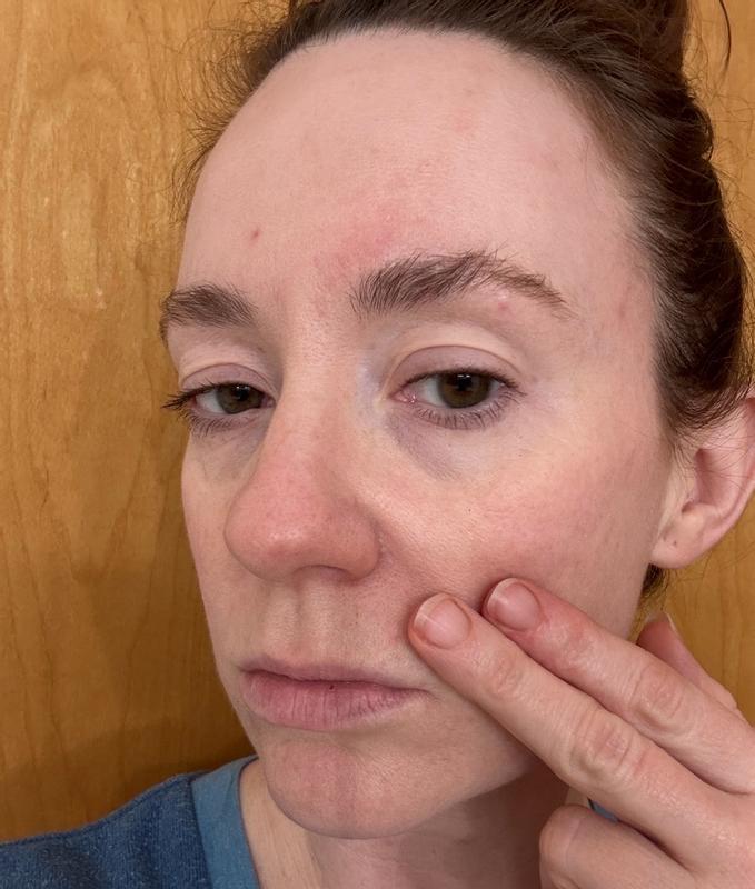 Customer photo for "Gives skin immediate smooth and hydrated texture"