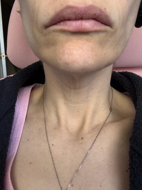 Review Thumbnail Image 2 383339140