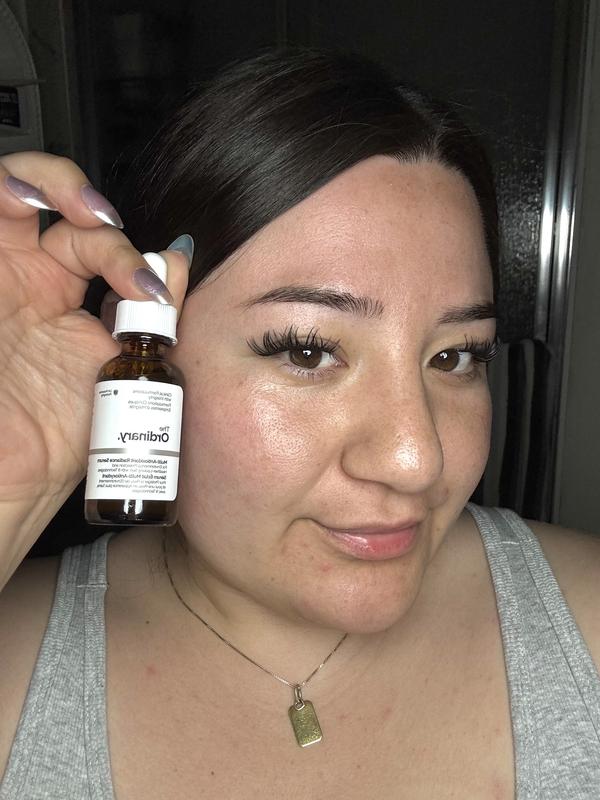 Customer photo for "Amazing lightweight serum for radiant skin"