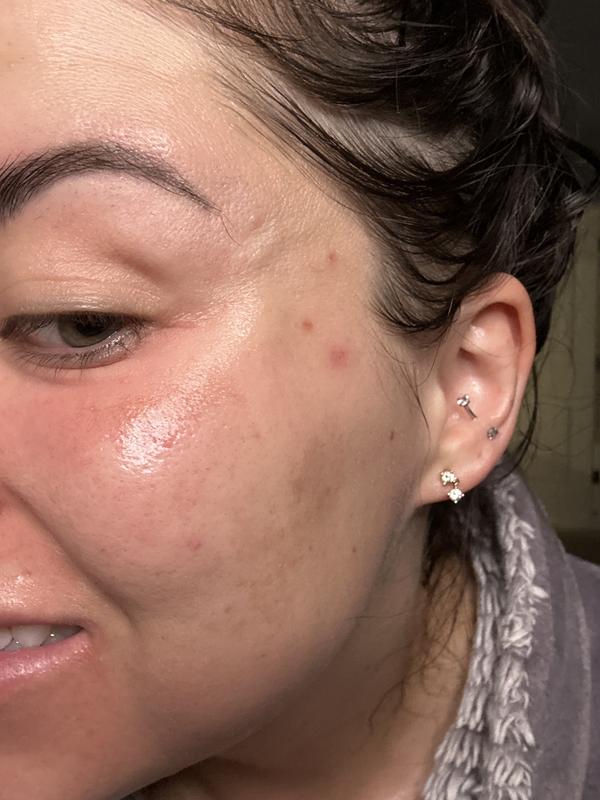 Review Thumbnail Image 0 382840318