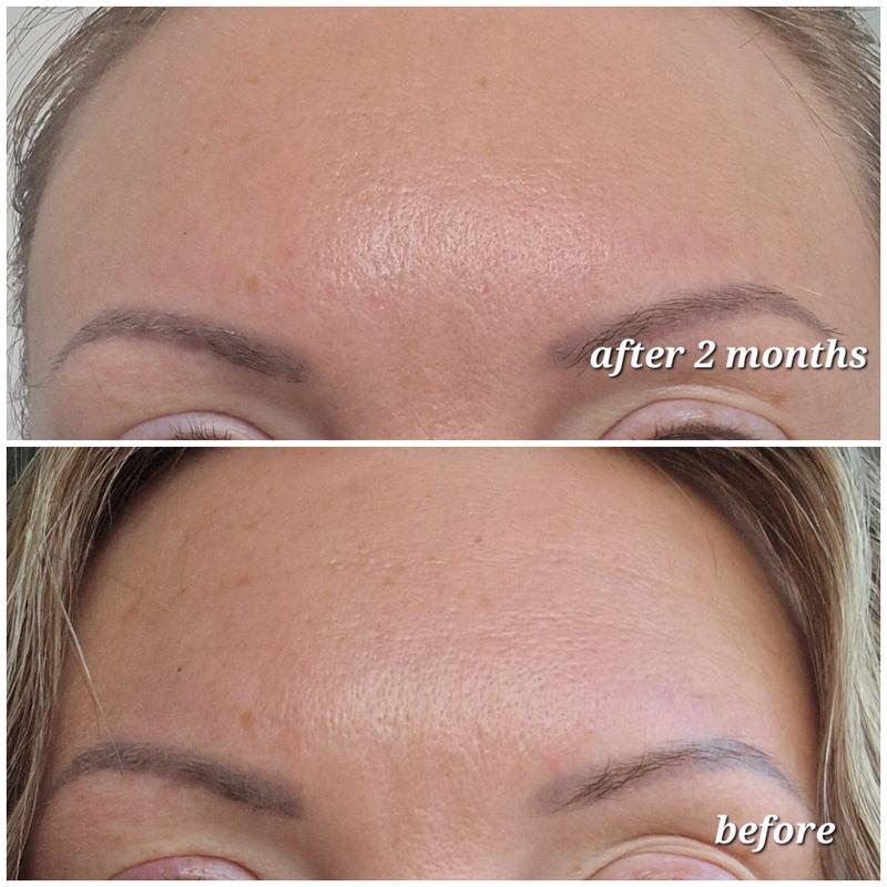 Fight Deep-Set Lines with Argireline Solution 10% Serum