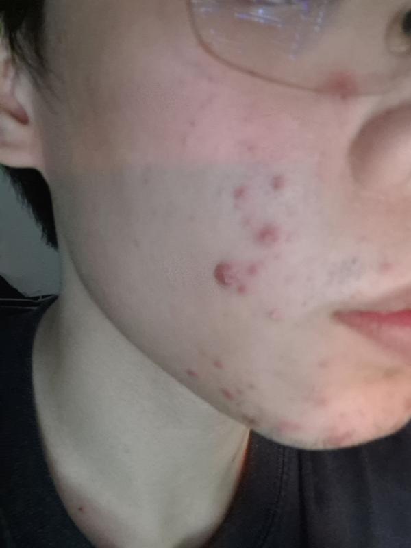 Customer photo for "Purging"