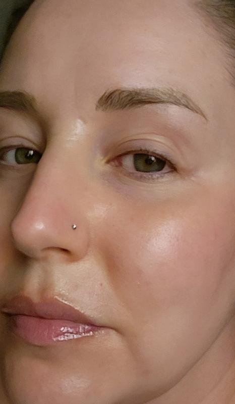 Customer photo for "Gentle retinoid with moisture!"