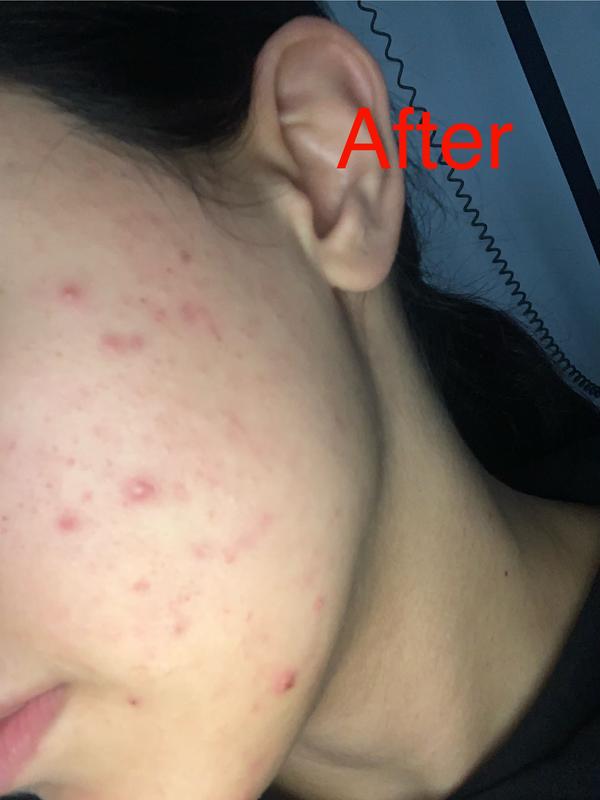Customer photo for "Ineffective"