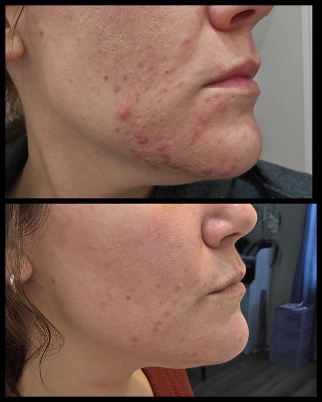 Customer photo for "Buy it yesterday!"