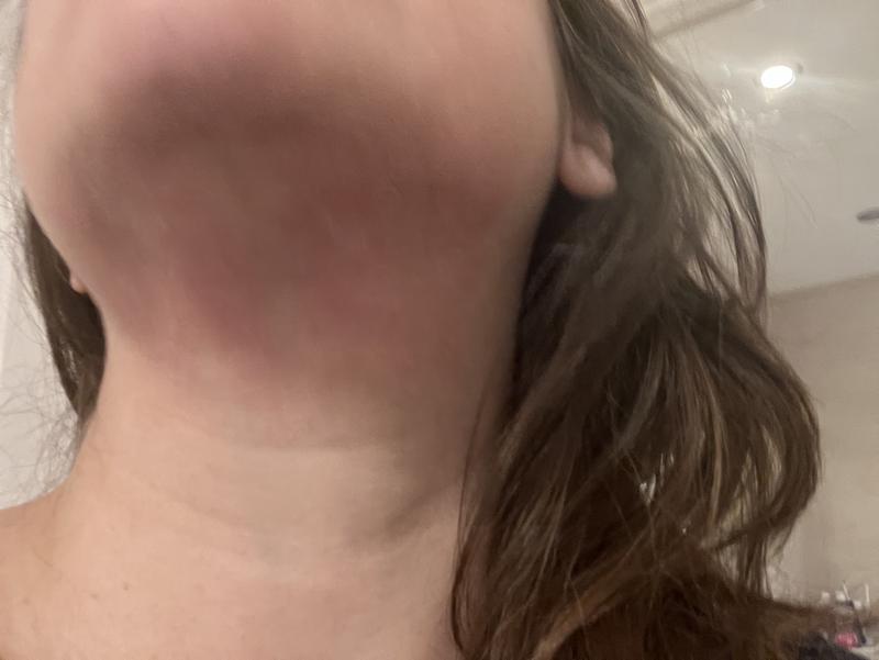 Review Thumbnail Image 0 379593868