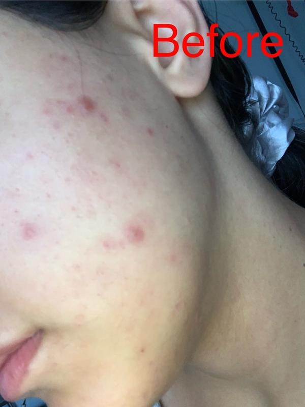 Customer photo for "Ineffective"