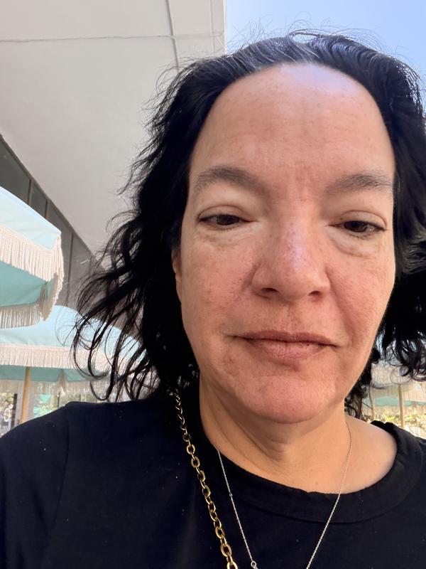 Customer photo for "The best for reducing dark spots and uneven skin"