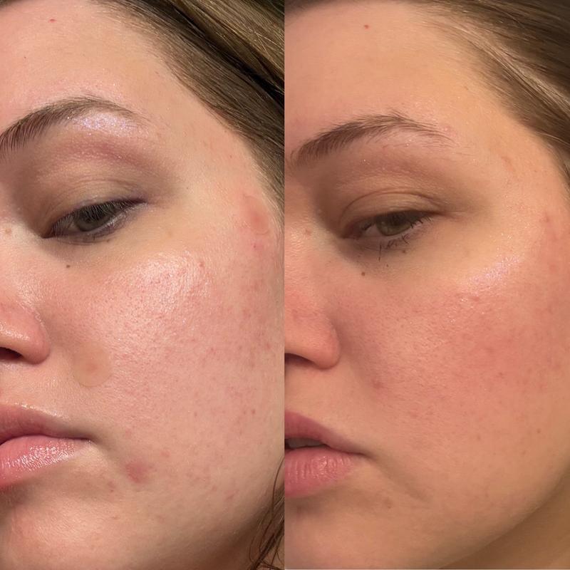 Customer photo for "Results are NOTICABLE!"