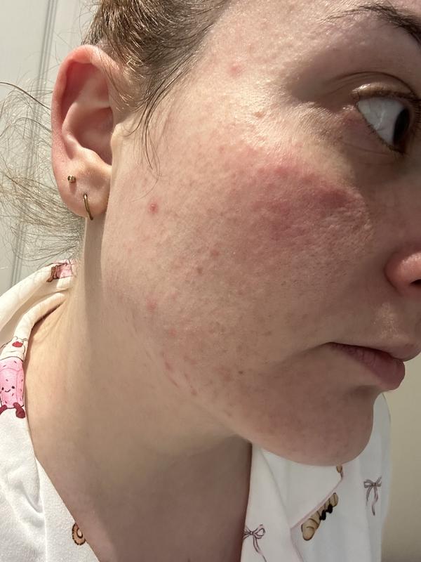 Review Thumbnail Image 1 384391010