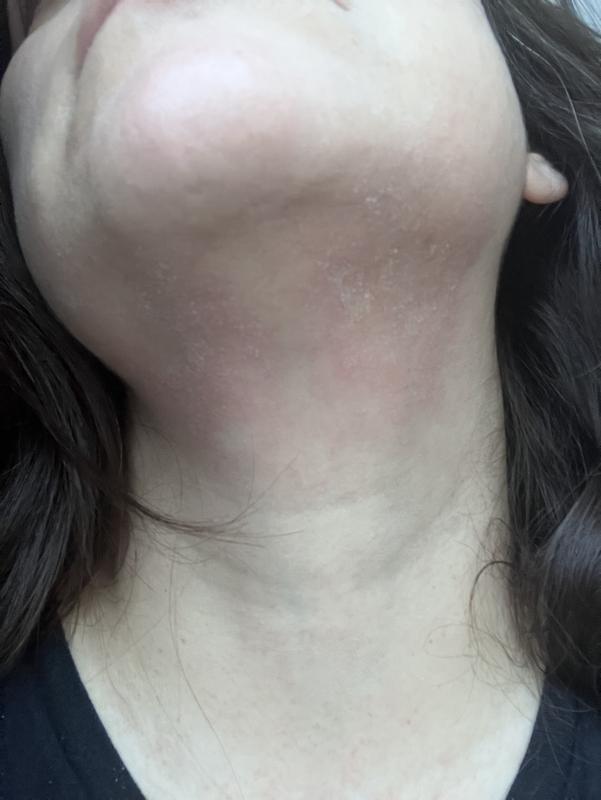 Review Thumbnail Image 2 379593868