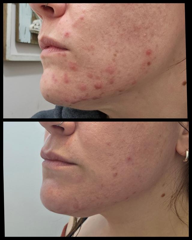 Customer photo for "Buy it yesterday!"