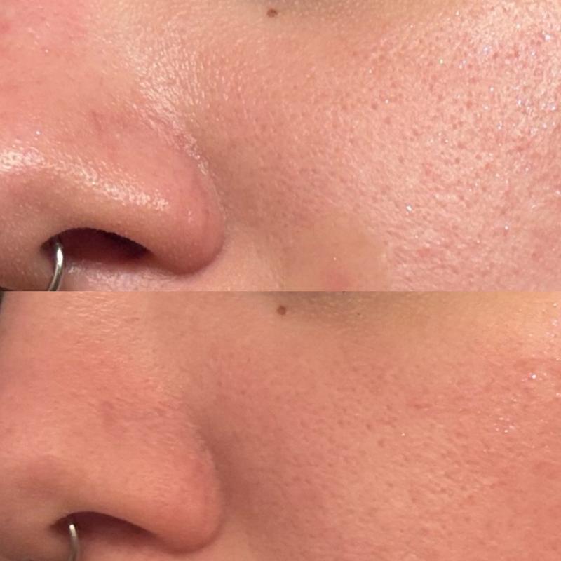 Customer photo for "Results are NOTICABLE!"