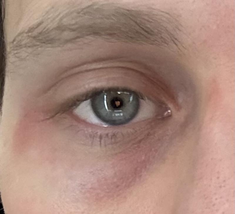 Review Thumbnail Image 0 377149363