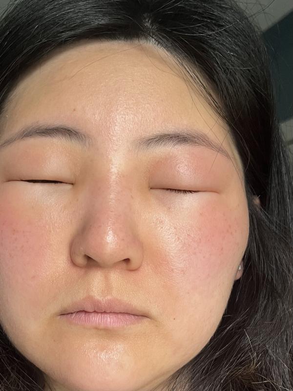 Customer photo for "Go to the ER for this"