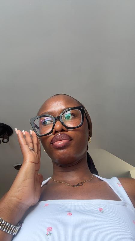 Customer photo for "For Acne"
