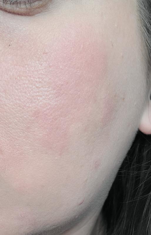 Customer photo for "Not for sensitive skin"