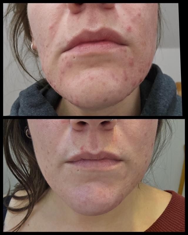 Customer photo for "Buy it yesterday!"