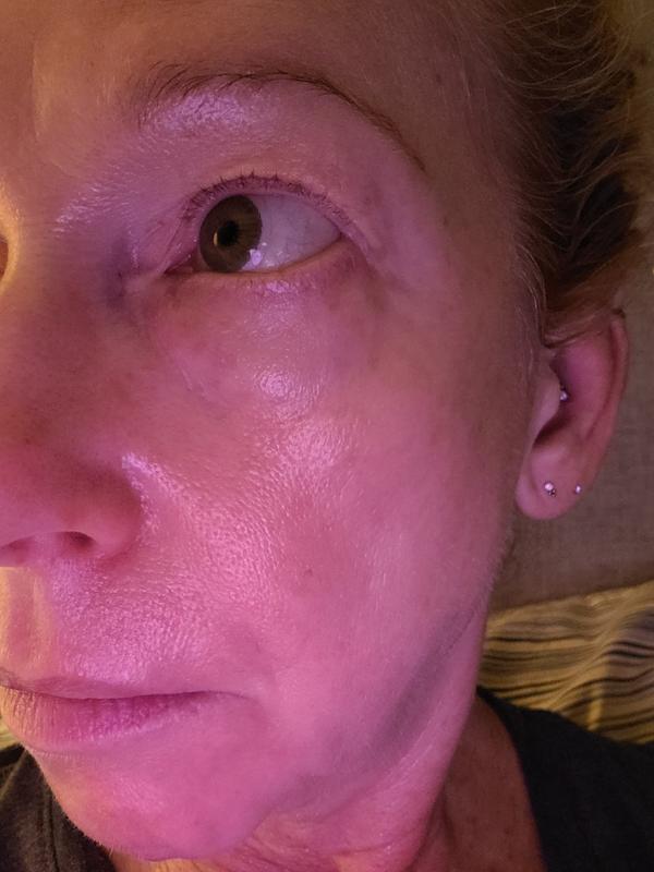 Customer photo for "Great for dry dull skin"