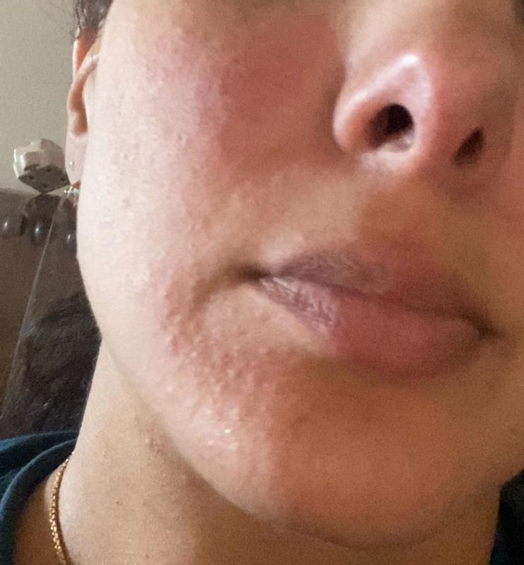 Customer photo for "Horrible!"